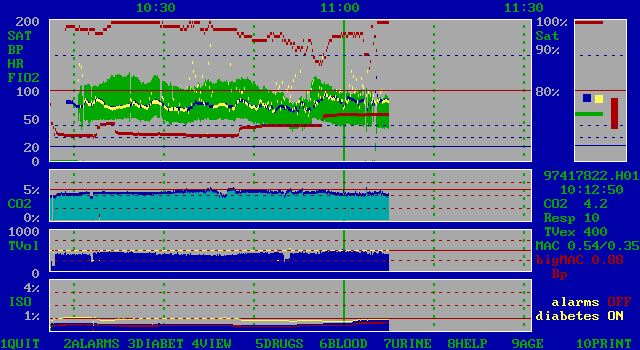 ars5a screenshot