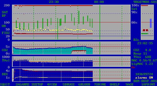 ars5a screenshot