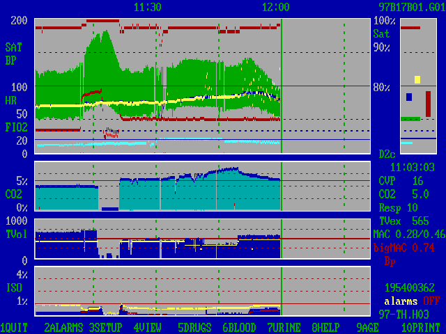 ars5a screenshot